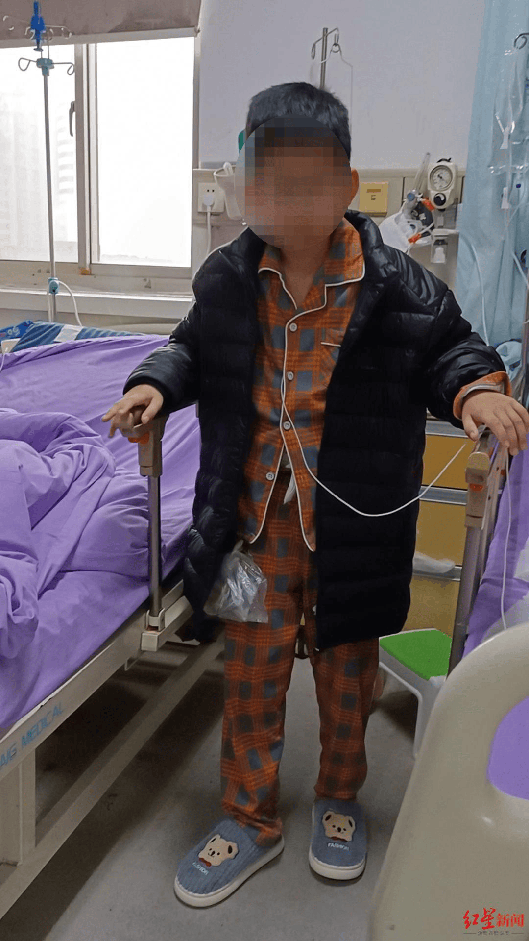 玩耍被撞后10岁男孩被诊断有肿瘤，多器官切除 当地卫健局：医院存在问题，已立案
