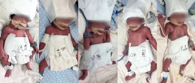 新疆一24岁产妇凌晨生下5胞胎（1男4女），最重1030克，最轻仅870克，概率六千万分之一